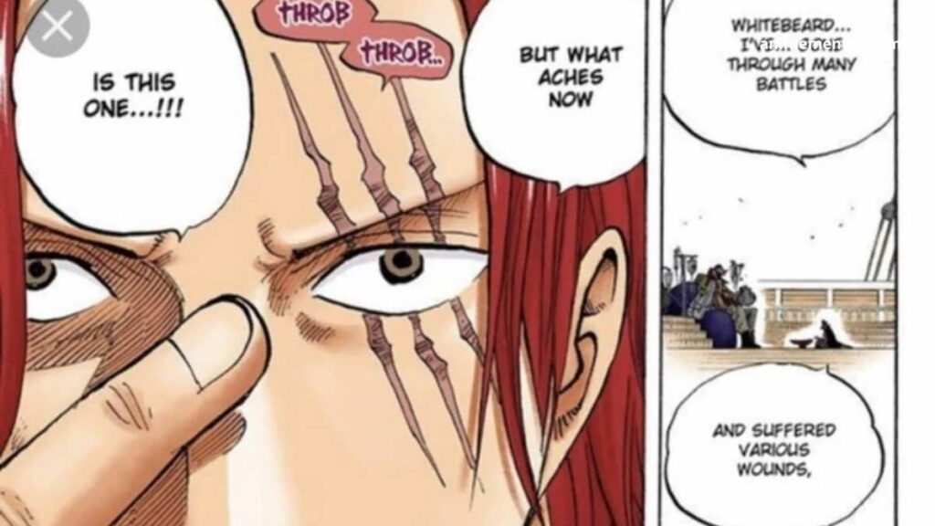 Shanks is the 3 scars on his eye, According to him, it was given t him by Blackbeard.